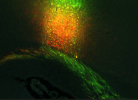 Projections from a motor cortex AAV injection (credit: )