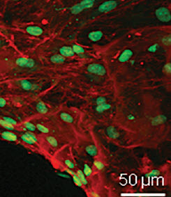 protein from bone stem cells
