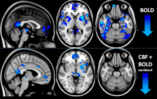 psilocybin