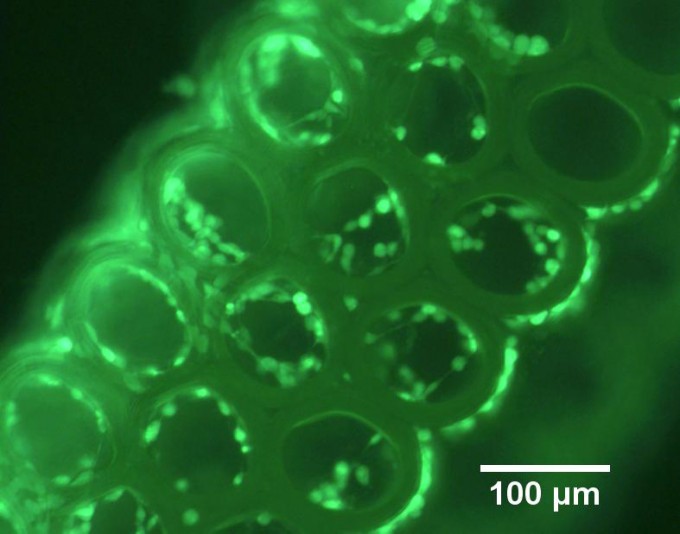 scaffold_for_tissue_engineering