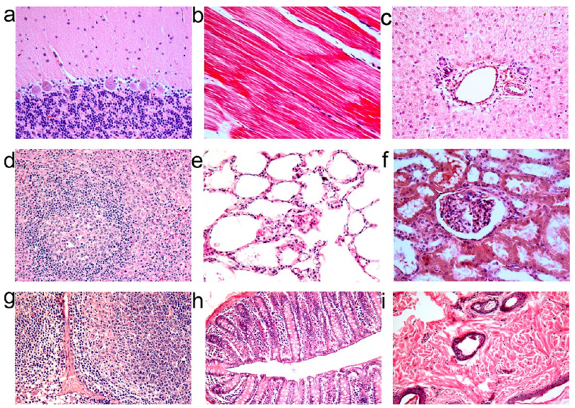 silicon nanoparticle induced toxicity