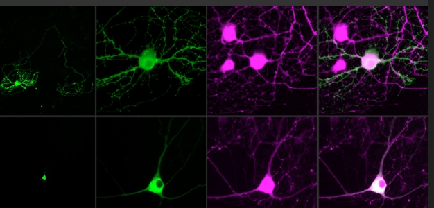 single neurons