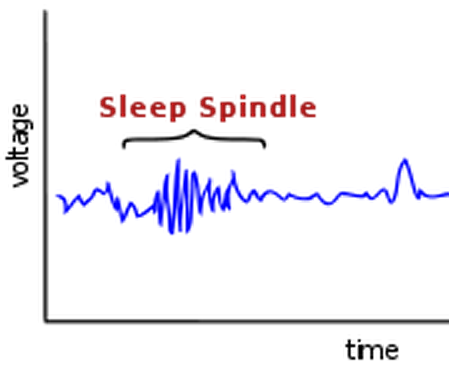sleep spindle
