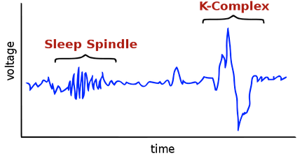 sleep spindle