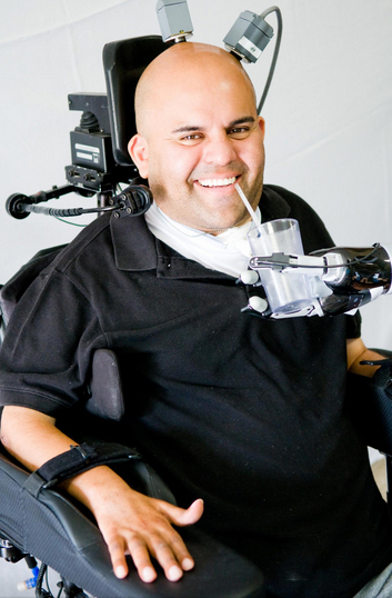 smart neuroprosthetic