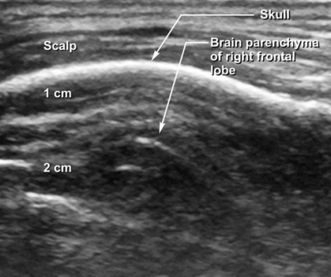 sonogram