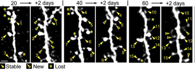 spine dynamics