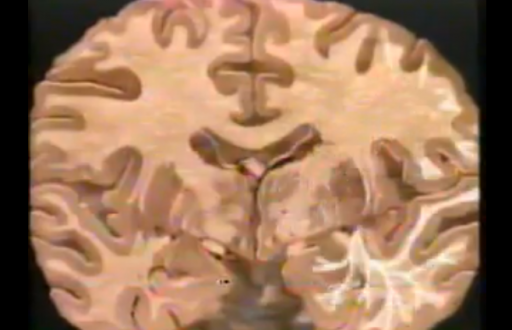 splitbrainexperiments