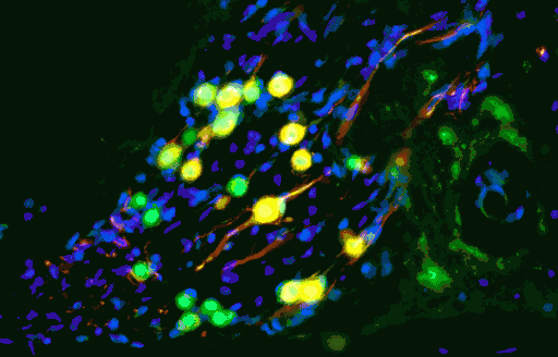 stem_cells_deafness