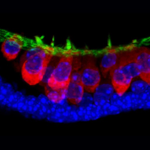 stem_derived_sensory_cells