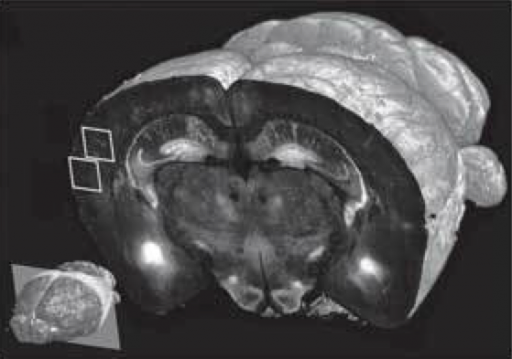 STP tomography