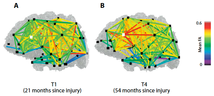 structural remodeling of the brain