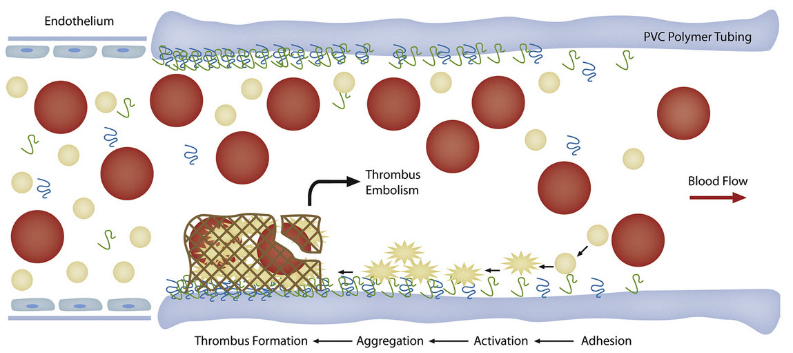 thrombus formation