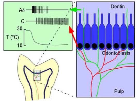 tooth pain fibers