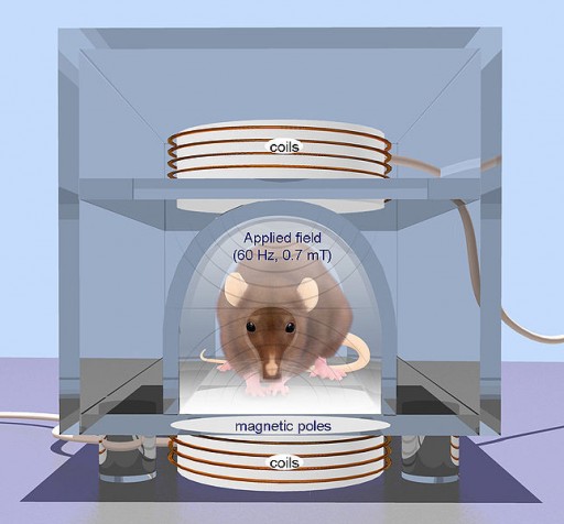 transcranial_magnetic_stimulation