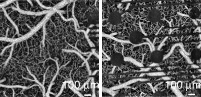 transparent vs. opaque electrodes