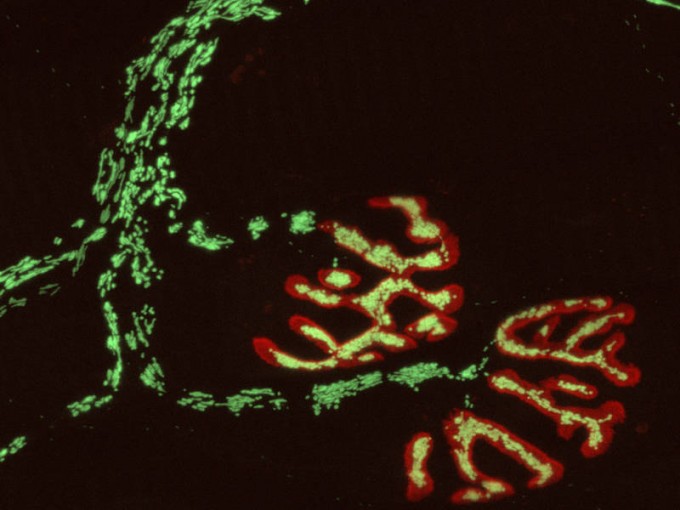 tum-cell-imaging
