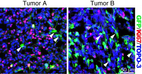 tumor_cells_gfp