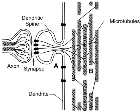ultrasound effects