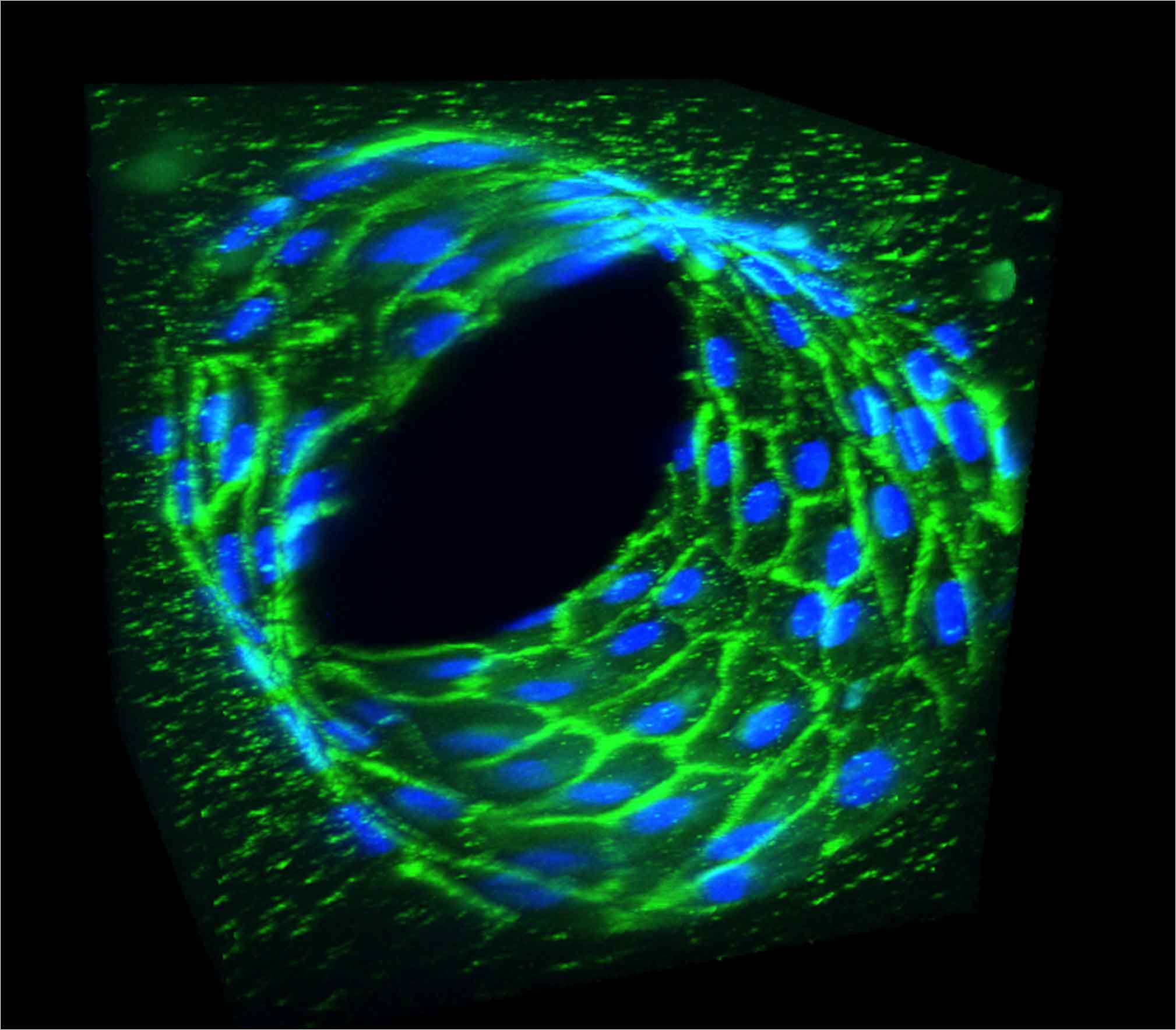 vein endothelial cells