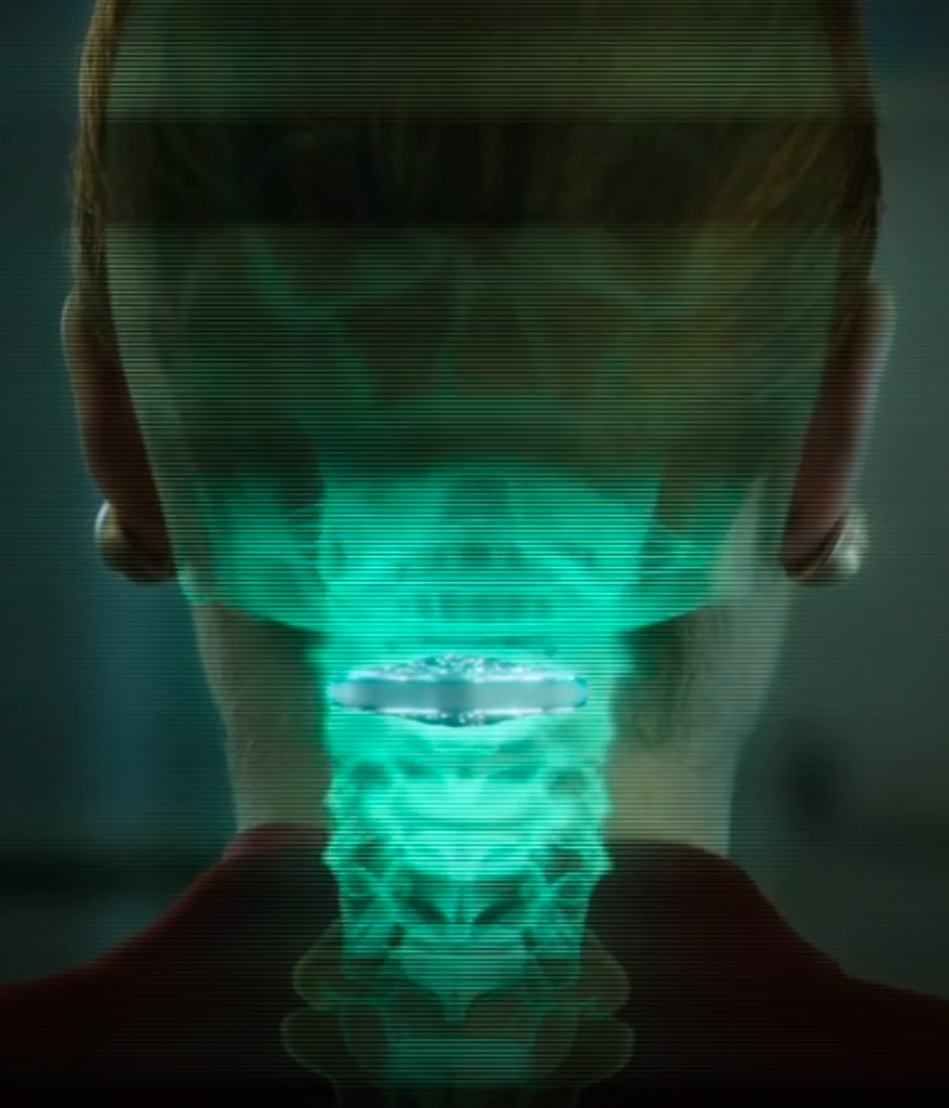 vertebral chip