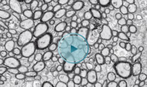 video_glimpse_nerve tissue video_glimpse_nerve tissue