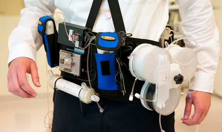 wearble artificial kidney