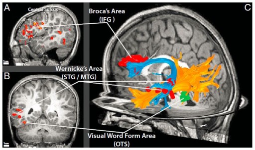 white_matter_connections_reading